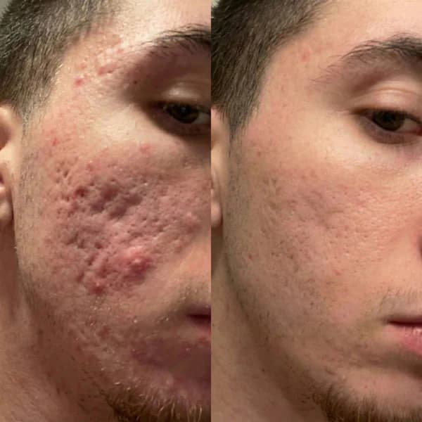 Paulo Augusto — Rejuvenescimento results