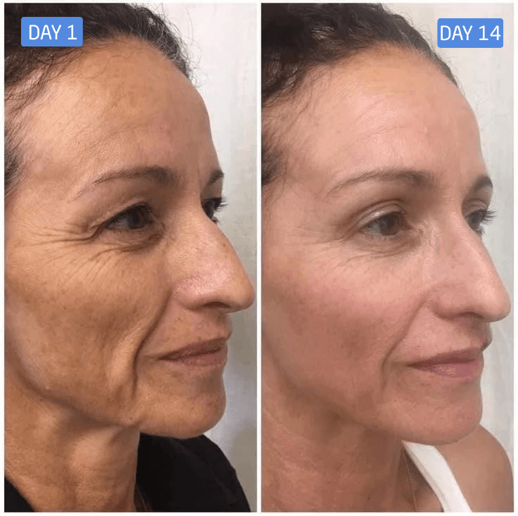Ana Paula S. result photo